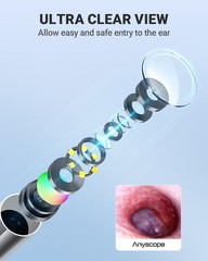 AnyScope Digital Otoscope Compatible with iPhone and Android Devices, Purple