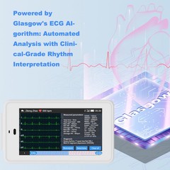 NEW 6/12-lead Electrocardiograph ECG EKG Machine + Glasgow ECG Interpretation