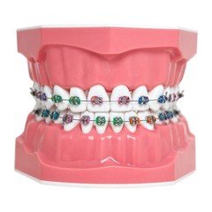 US Dental Typodont Ortho Teeth Model With Metal Braces for Brushing Practice