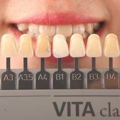 New 1 Set VITA Classical Dental Shade Guide 19Colors with Bleached Shades Clip