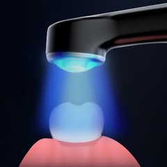 Woodpecker O-Star Style Dental LED Curing Light 1S Cure 3000mW/cm² OLED Screen