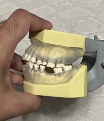 KM-C-210 Articulated Periodontal Soft Clear Gingival Typodont Model
