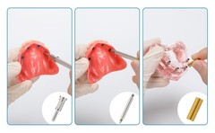 US Overdenture Locator Core Tool Retention Male Caps Implant Inserts Extraction