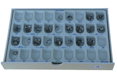 molar bands