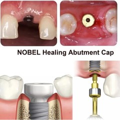 US Nobel Biocare Titanium Healing Abutment NP RP Internal Conical ∅3.6/5.0/6.0mm