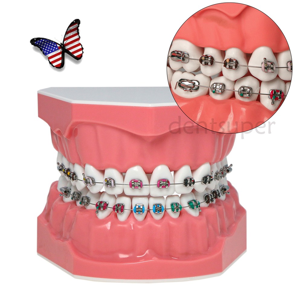 US 1:1 Dental Orthodontic Teeth Model Typodont Demonstration Model with Brackets