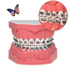 US 1:1 Dental Orthodontic Teeth Model Typodont Demonstration Model with Brackets