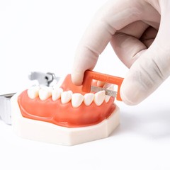 Dental Orthodontic IPR Reduction Strip Polishing saw Interproximal Enamel Strips