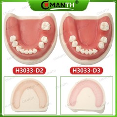Multiple Types Dental Teeth Model Ortho Implant Practice Teaching Demo Model