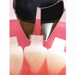 Ceramic Bracket Remover Pliers Straight or Angled Orthodontic N21150875/ 0876