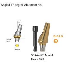 US Dental Titanium Hex A/B 17° Angled Abutment for Hiossen ET Mini Regular Plat