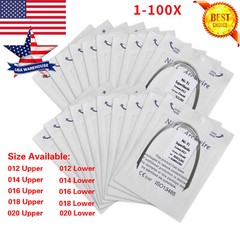 Dental Ortho Super Elastic Niti Round Arch Wire Ovoid 012-020upper/lower all