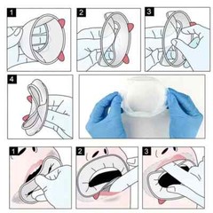 10pcs Ivoclar Vivadent Optragate 3D Lip Cheek Retractor Dental Mouth Opener