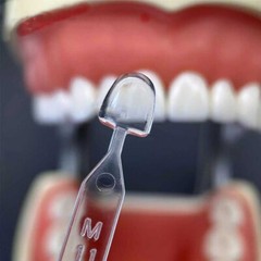 30pcs Dental Composite Resin Veneers Mould Light Cure Anterior Front Teeth USA