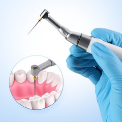 AZDENT Dental Cordless LED 16:1 Endo Motor /Apex Locator /Endo Rotary Files