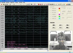 KT88-2400 24 Channel EEG Brain Electrical Activity Mapping System Software