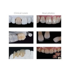 US C14 Emax Dental Glass Ceramic HT LT Lithium Dislicate CAD/CAM Cerec Blocks