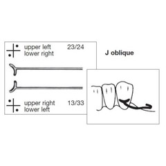 0.8 0.9 1.0 Dental Ball Retainer J Clasp Oblique Clasps Bars Y-Type Scheu Style