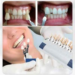 VITA Dental Lab Resin Toothguide 3D Master with Bleached Shade Guide 29 Colors