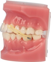 Fun, Functional & Safe – 100 Packs of 3/16″ Dental Elastics, Made in America