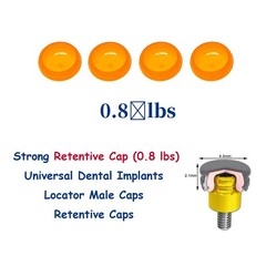 Locator Abutment for Hiossen ET DIO UF/Snucone Regular Overdenture Retention Cap