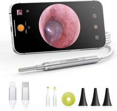 Digital Otoscope Compatible with iPhone and Android Devices Video Ear Scope