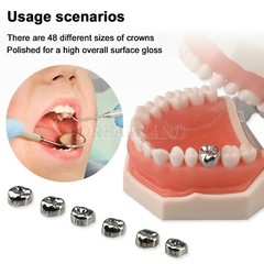 48 ASSORTED PRIMARY MOLAR STAINLESS STEEL CROWNS – COMPLETE KIT
