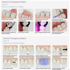 Transparent Matrix Bands Clear Dental Bow Matrice Band Anterior Front Bioclear