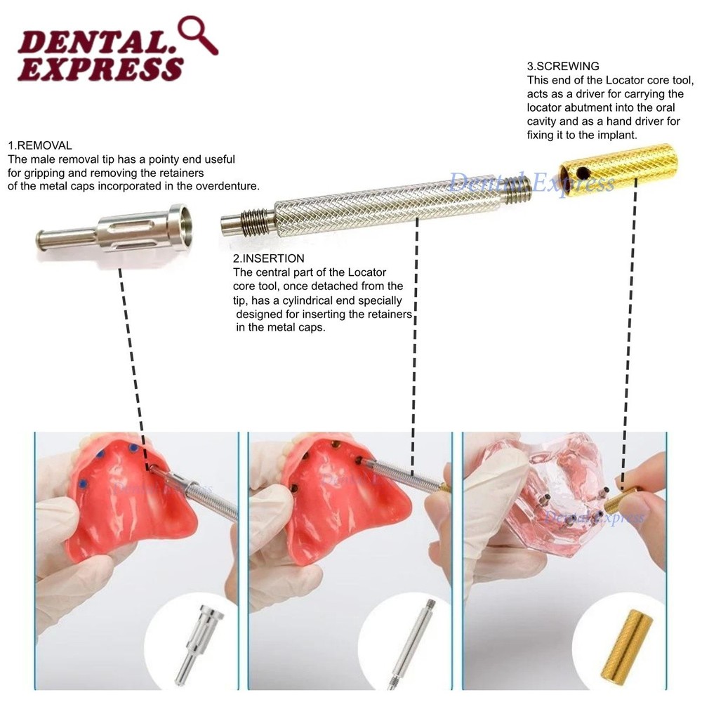 Dental Universal Implant Locator Caps Remove Core Tool For Retention Caps 3 in 1