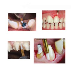 1PC Dental Surgical Soft Tissue Trimmer Bur Gingival Gingivectomy 23mm