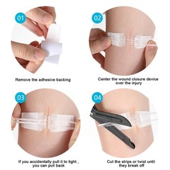 Wound Closure Strips Sterile Skin Suture Strip 5PCS First Aid Adhesive…