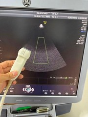 GE IC5-9-D Vaginal probe for GE Voluson E8 , E6 ,Logic & E9 Ultrasound
