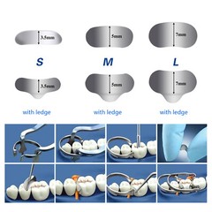 50Pcs Dental Matrices Bands Sectional Contoured Metal Matrix bands soft S/M/L