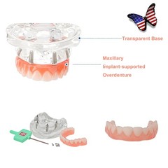 US Dental Overdenture/Implant/Orthodontic Typodont Ortho Training Teaching Model