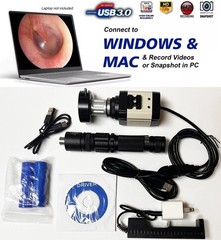 Rigid Endoscope Cystoscope Arthroscope HD USB Camera Head+Coupler+Light Source