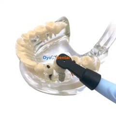 Dental Implant Detector 3D Implant Locator System 270° Rotating Sensor Spotting