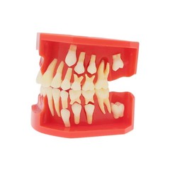 Teeth Typodont Dental Model – Eruption Development, Deciduous Teeth, Dental Educ