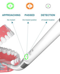 Dental Surgical 360° Rotating Implant Locator 3D Smart Spotting Implant Detector