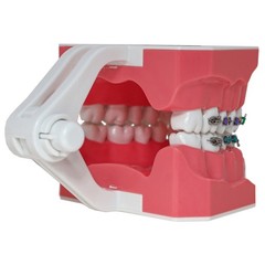 US Dental 1:1 TypodontTeeth Model Orthodontic with Metal Brackets Brace M7010-2