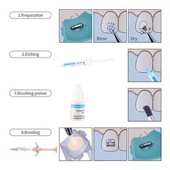 Dental Composite Resin Adhesive Kit /Mini/No-Mix Bonding/Light Cure/Blue Glue