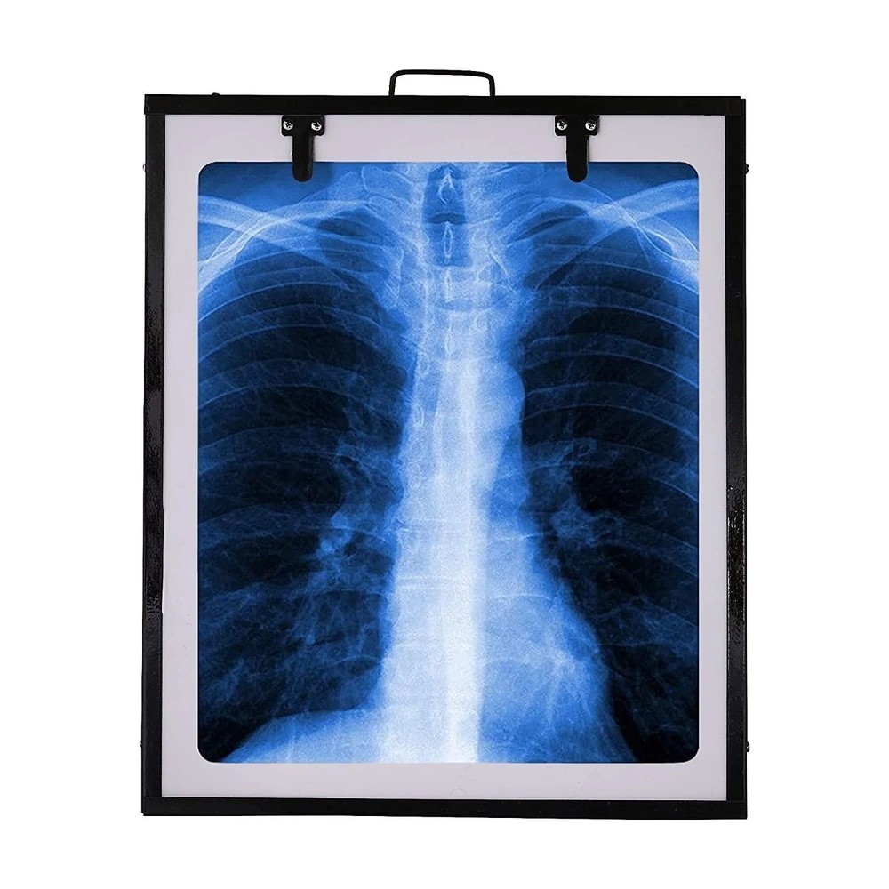 LED X-Ray View Box Single Film w Brightness Control Auto Sensor Black
