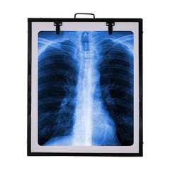 LED X-Ray View Box Single Film w Brightness Control Auto Sensor Black