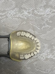 KM-C-210 Articulated Periodontal Soft Clear Gingival Typodont Model