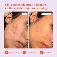 Tower 28 Sos Daily Rescue Facial Spray For Sensitive Skin Hypochlorous Acid