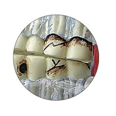 TMJ – Temporomandibular Joint Anatomical Model GPI LFA #2880 SEE VIDEO