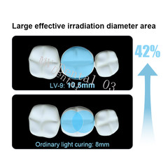 1 Second Dent Curing Light Dental Led Curing Light Lamp Whole Metal Body