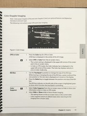 SonoSite MicroMaxx PORTABLE ULTRASOUND with C11e/P17/ECG probes, tested, due2025