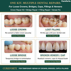 Cureforte Zinc Oxide Eugenol Dental Cement Kit – Clear/Transparent