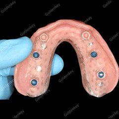 Dental Overdenture Locator Abutments Retention Caps For Implant Inserts