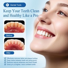 Dental Cleaning & Whitening Kit for Personal Use, 7 Count (Pack of 1)